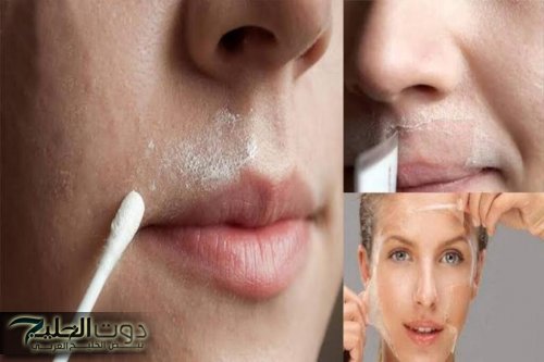 طريقة إزالة شعر الوجه بمكونات بسيطة في المنزل واختفائه لشهور طويلة في دقائق معدودة