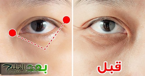 «جارتي الهندية قالتلي عليها»... وصفة فعّالة لإزالة تجاعيد الوجه والعينين وتفتيح البشرة بطرق طبيعية ومذهلة من أول استخدام