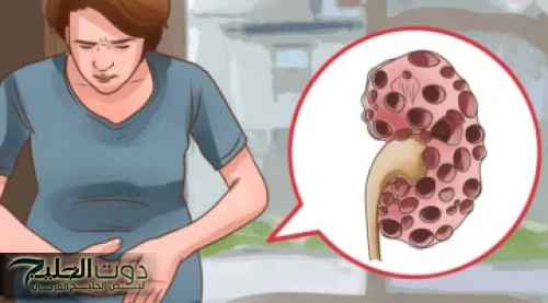 يابخت اللي جربها...!! كنز من كنوز الدنيا موجود في مطبخك مكون غذائي يعالج مشكلة الإمساك بسهولة تامة!!