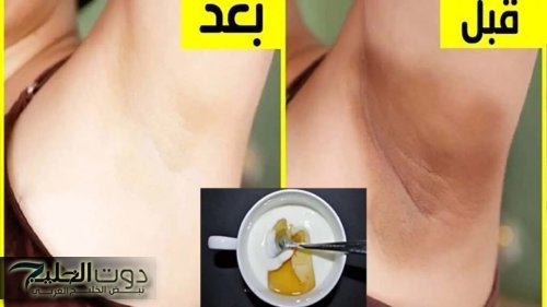 طريقة عمل وصفة الزبادي والترمس المبهرة في تبييض المناطق الغامقة بالجسم