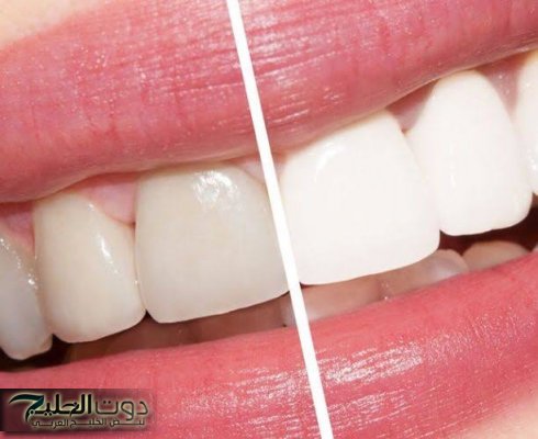 "سنانك هتبقي زي اللؤلؤة"...!! وصفات طبيعية مدهشة لـ تبييض الأسنان بمكونات منزلية اقتصادية!!