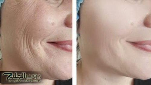 ودّعي التجاعيد والبقع الداكنة.. وصفة سحرية لتفتيح البشرة وشد الوجه من أول مرة!