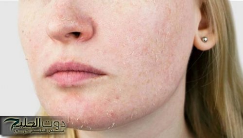 "سر العناية بالبشرة في الشتاء".... وصفات طبيعية تمنحك النضارة والنعومة