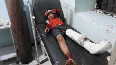 أخبار اليمن : قذيفة للمرتزقة تصيب طفلاً في تعز