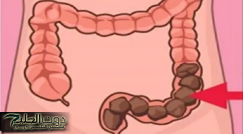 "حل جبار يغنيكي عن الدكاترة!"... شابة أردنية تكشف عن عشبة جبارة موجودة في كل مطبخ تنظف القولون في 5 دقائق وتعتبر الحل الأمثل للتخلص من البراز المتحجر!