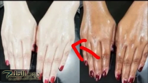 "أقوى وصفة سحرية لتبيض الوجه واليدين والقدمين".. وإزالة سواد الشمس والقضاء على حب الشباب والهالات السوداء وتوحيد لون الجسم!