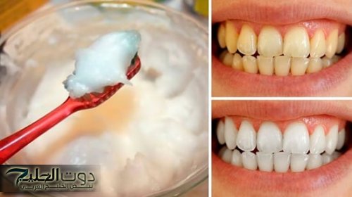 انسى انك تروح لدكتور الاسنان مرة تانية!!... طريقة تبييض الاسنان في المنزل في اقل من 5 دقايق!
