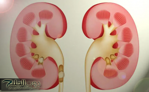 عشبة ربانية تفتت حصوات الكلى وتعالجها بدون ألم في أيام قليلة