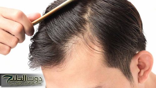"اشياء بتعملها وانت مش واخد بالك".. سبب غريب لتساقط الشعر..كيف تتعامل معه؟