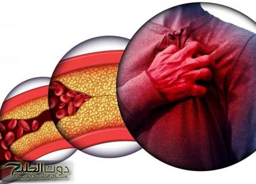 الكوليسترول عندك عالي ومش عارف تظبطه؟.. إليك أفضل الحلول المثالية لضبط نسبة الكوليسترول في الدم