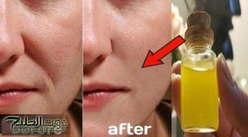 "انسي عمليات التجميل تاني".. طريقة عمل سيروم طبيعي للحصول على بشرة مشدودة وخالية من التجاعيد والتصبغات بدون بوتوكس !!..كنز من كوريا !!