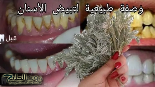 أهم عشبة للجميع .. أعشاب تعالج اصفرار الأسنان ورائحة الفم الكريهة.. تعرف عليها الآن وامتلك ابتسامة رائعة