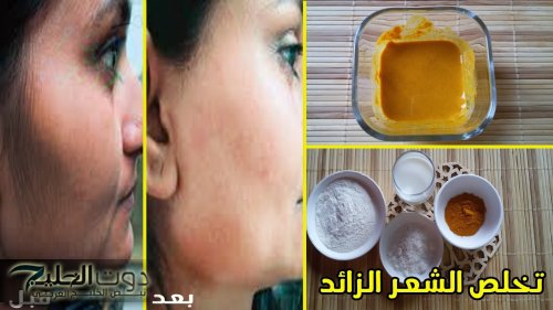 كنز رباني ستجديه في بيتك لإزالة الشعر تماماً من الوجه والجسم هيخليكي ناعمة من غير أي شعيرات