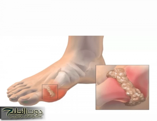 "عشبة سماوية".. تعالج النقرس والملاريا وآلام المفاصل وانسداد الأمعاء ولها فوائد لا تخطر على بال أحد!!