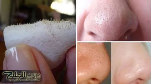 وصفه مبهره.. انسي البثور والبقع السوداء مقشر النشا والخل في ثواني هتكونى ملكة جمال