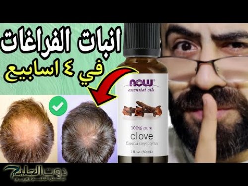 نفسك في شعر ريبونزل جبتلك وصفة سحرية!! ضعي الزيت على فروة رأسك ومش هتصدقي النتيجة!!.. وداعا لكل الحيل القديمة هتقولي ياريتني عرفتك من زمان!!