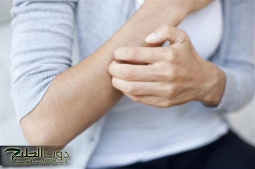 "ياريتني عرفتها من زمان"...علامات خطيرة تظهر على الجلد تدل على ارتفاع الضغط والسكري!!