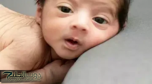 "حالة طبيعية ولا مرض"...كثافة الشعر على جسم المولود | لماذا يولد بعض الأطفال بشعر كثيف؟