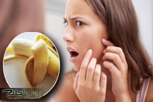 “طلعة كنز مابيترميش”.. قشور الموز استخدامته رهيبه من اليوم مش هتستغني عنه نهائيا