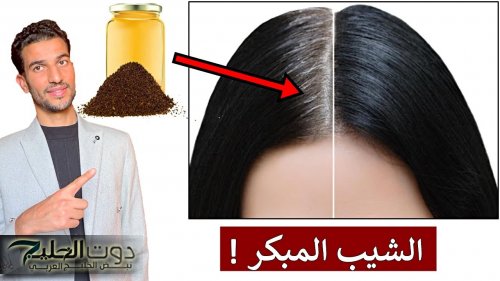 مكون طبيعي يخلصك من الشعر الأبيض في أيام قليلة