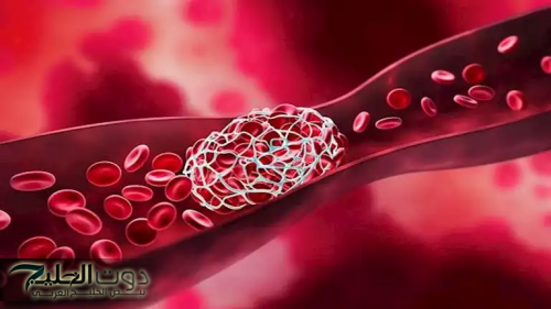 مشروبات تحميك من خطر الإصابة بالجلطات المفاجئة