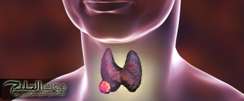 مشاكل الغدة الدرقية: الأعراض والعلاج