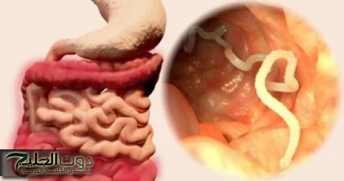 الدودة الشريطية: الخطر الخفي في طعامك