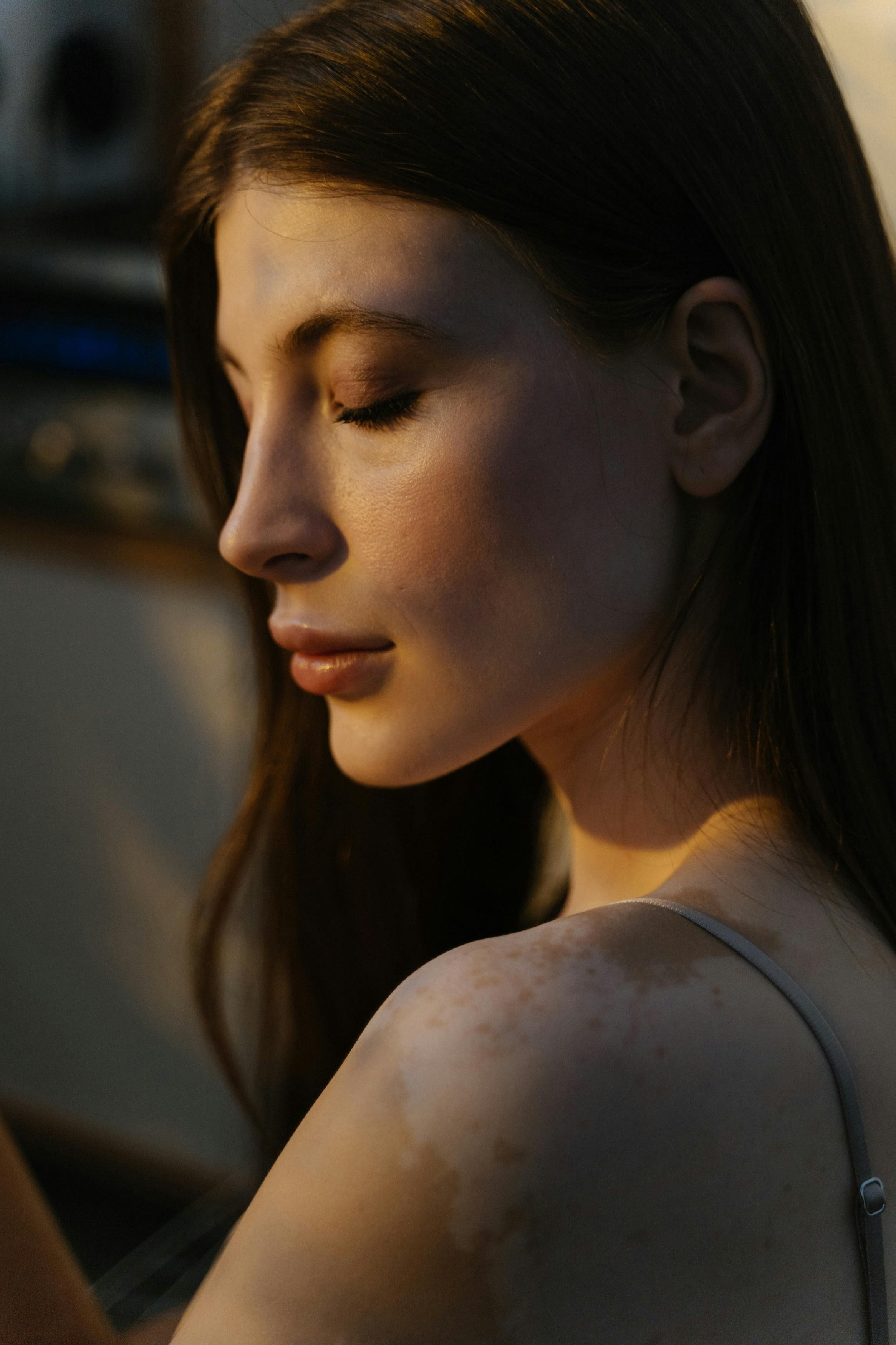 بكتيريا معوية مفيدة.. قد تحمل الأمل لمرضى البهاق: إليكِ التفاصيل