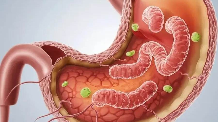 8 أطعمة تساعد في علاج جرثومة المعدة