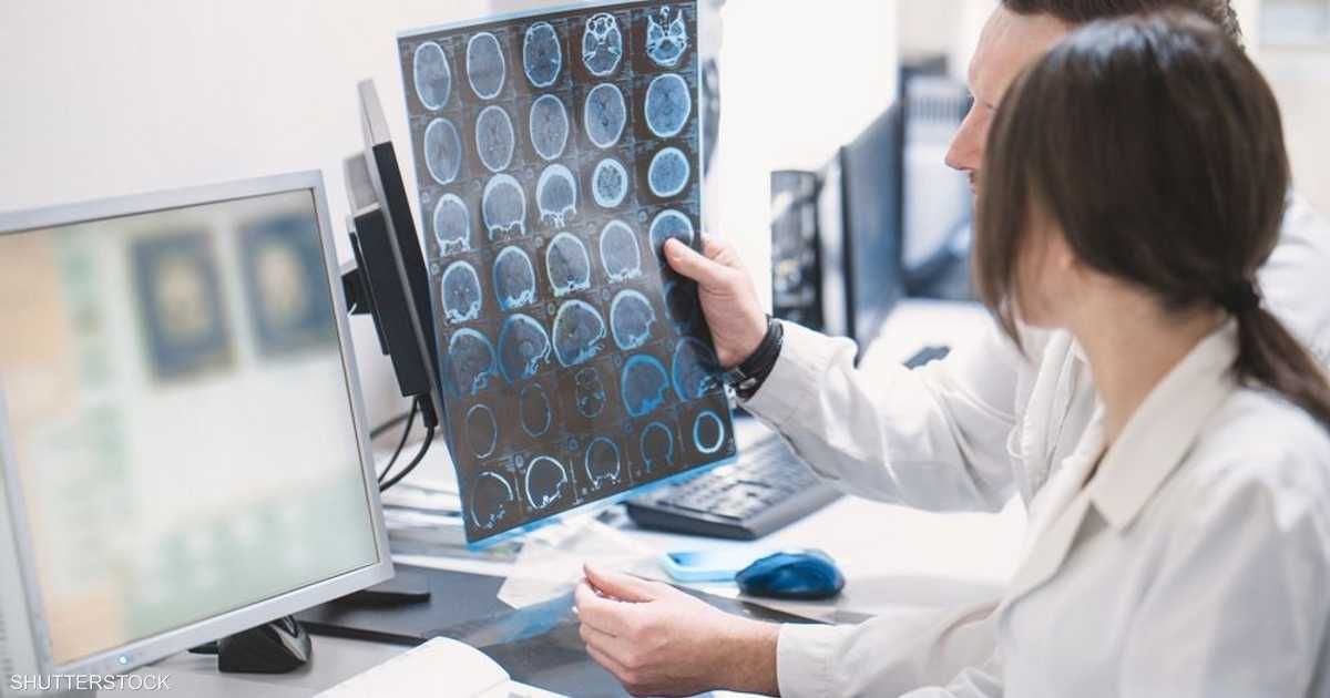 العالم اليوم - عبر الوريد.. أوروبا توافق على دواء لعلاج الزهايمر