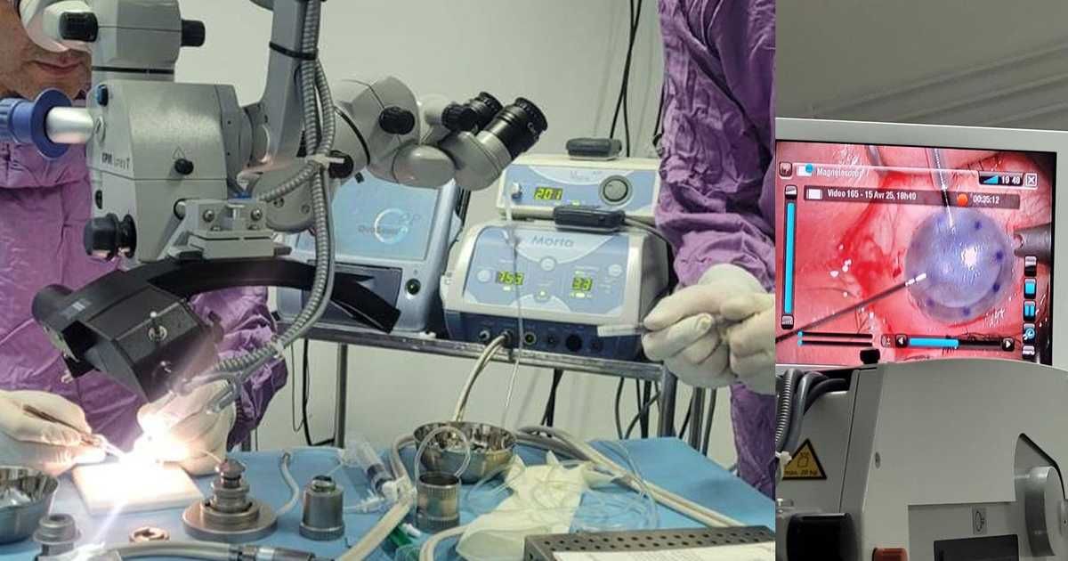 العالم اليوم - إنجاز طبي تونسي.. زراعة قرنية بتقنية مبتكرة