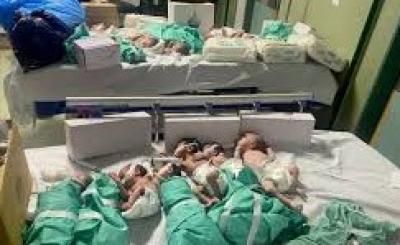 أخبار اليمن : مجمع ناصر: سوء التغذية يفتك بأطفال غزة