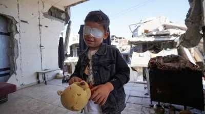 أخبار اليمن : 1500 غزي فقدوا البصر بسبب العدوان