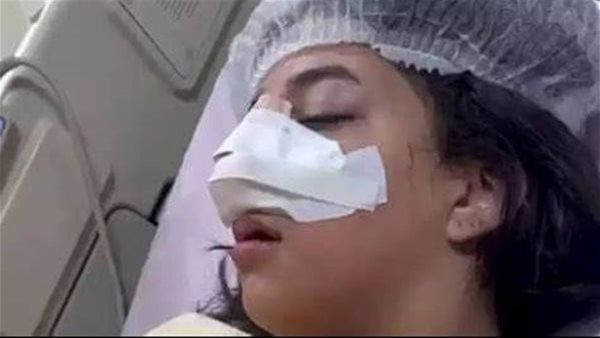 إحالة قضية الطالبة كارما إلى نيابة الطفل بعد إثبات تعرضها لعاهة مستديمة