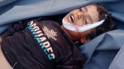 أخبار اليمن : قذيفة للمرتزقة تقتل طفلاً في مقبنة تعز