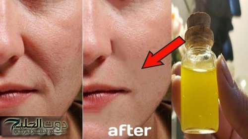 «اكتشفت سر وصفة سيروم طبيعي» … خلت بشرتي مشدودة وأنعم من قبل.. ودعت التجاعيد والخطوط الرفيعة من غير بوتوكس