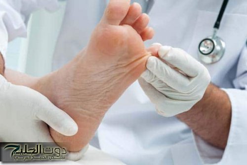 تحذيرات طبية هامة للأشخاص المصابين بالسكري: تجنب المشي حافياً لحماية القدمين