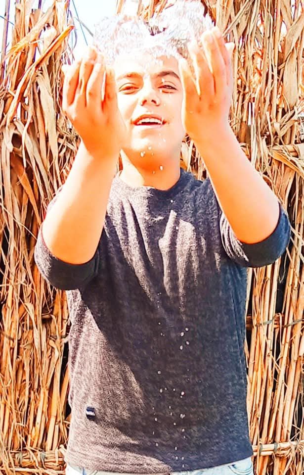 وفاة شاب بعد إجراء عملية غدة بالبحيرة.. والأسرة: “ثقب خاطئ في القصبة الهوائية”