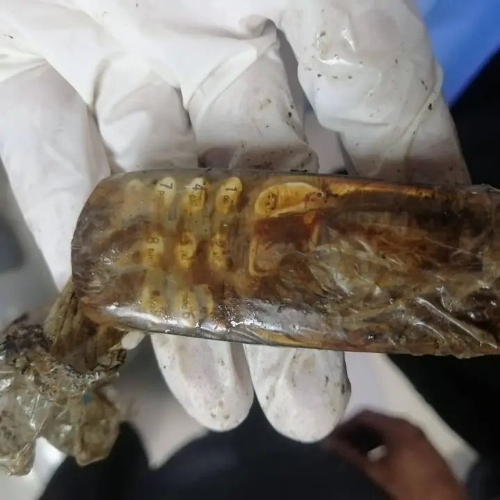 بعد عامين من الألم.. طب الأزهر بأسيوط يُنهي معاناة سجين ابتلع هاتفا