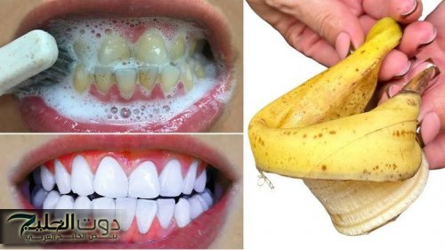 تبييض الأسنان وإزالة الجير بسرعة في دقيقة واحدة من أول استعمل للحصول على ابتسامة ساحرة