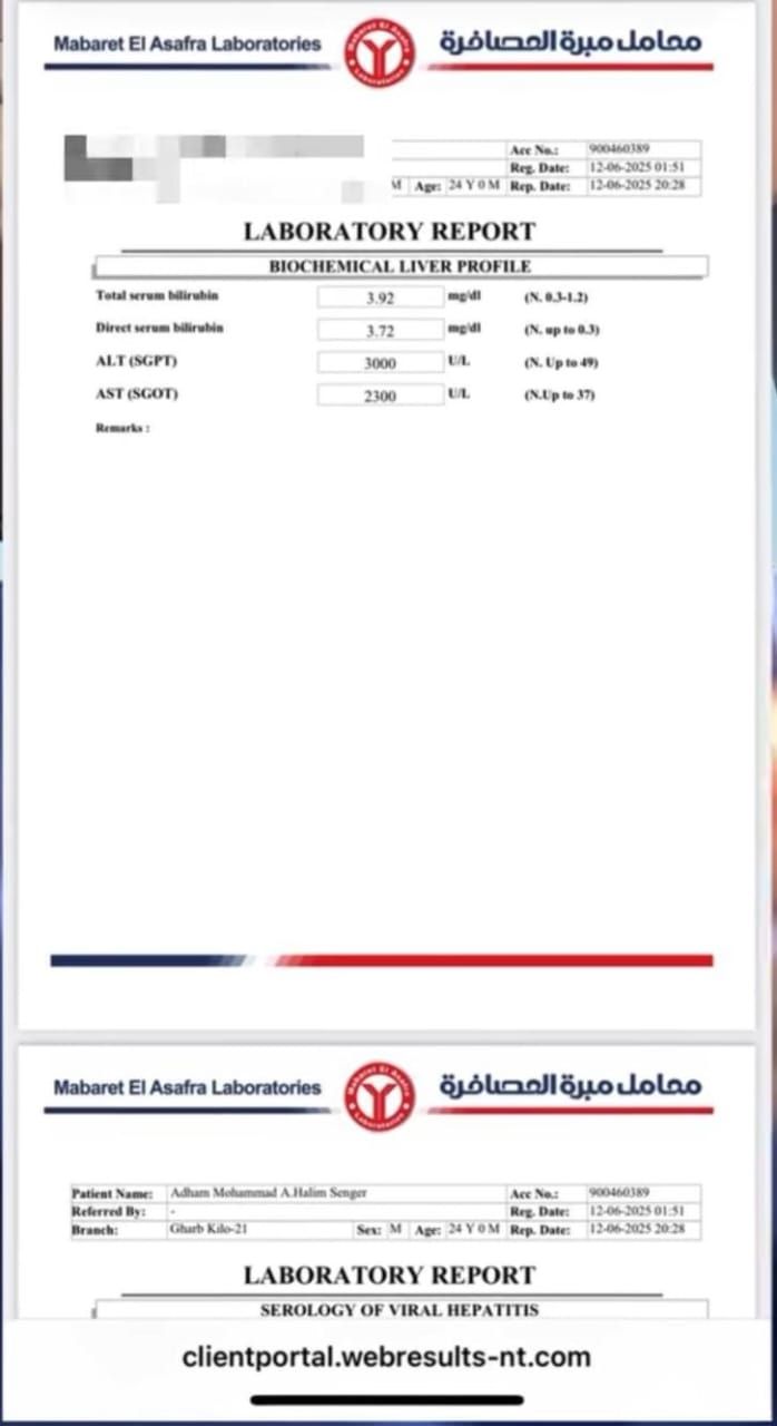 عاجل: بسبب “رفيوهات” المطاعم.. فود بلوجر شهير يعلن إصابته بفيروس الكبد