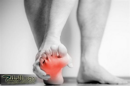 احذر قبل فوات الاوان .. هذه العلامات إذا ظهرت في القدمين فهي تشير إلي مرض قاتل في القلب هيوديك القبر علطول