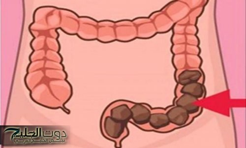 هتريح قولونك للأبد».. العشبة السحرية لتنظيف القولون هتخلصك من البراز المتحجر بسرعة البرق | مش هتحتاج تروح لدكتور