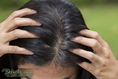 لن تنزعجي بعد اليوم.. طريقة استخدام الفازلين للقضاء على الشعر الأبيض والشيب المبكر نهائيا بدون استخدام