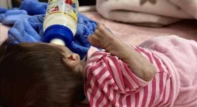 أخبار اليمن : الأونروا: سوء التغذية تضاعف في غزة