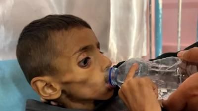 أخبار اليمن : الجوع يقتل 18 غزياً خلال 24 ساعة