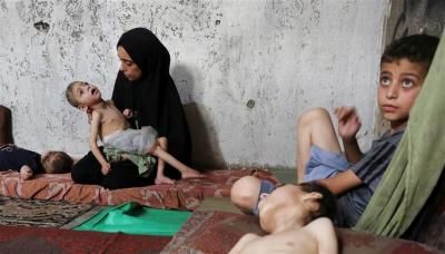 أخبار اليمن : 90 ألف شخص في غزة يعانون من سوء التغذية