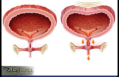 «كل مرة تستحملي التبول وانتي مشغولة؟!».. اعرفي إزاي العادة البسيطة دي ممكن تدمر مثانتك وتسبب مشاكل صحية