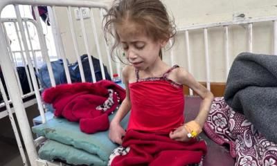 أخبار اليمن : التجويع يفتك بغزة: 193 شهيداً بينهم 96 طفلاً