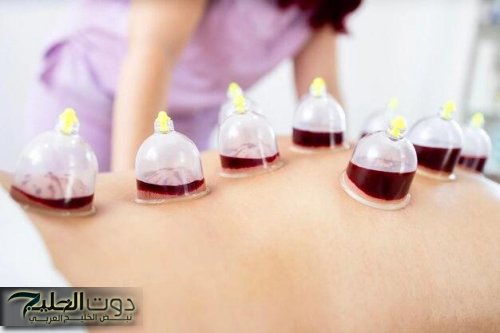 لماذا ينصح الأطباء بالحجامة؟ 7 فوائد مذهلة لصحتك..لكن احذر هذه الأخطاء الشائعة